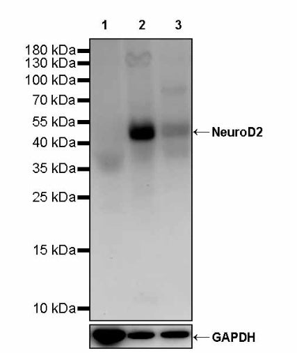 NeuroD2 Recombinant Rabbit mAb (S-3092-64)