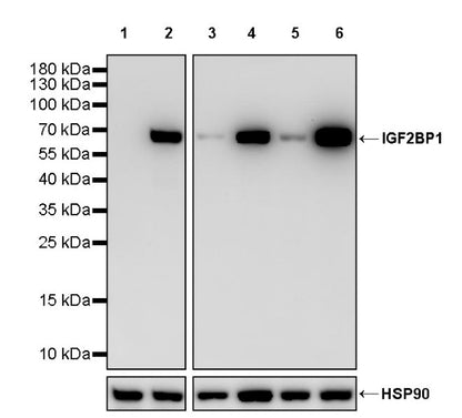 IGF2BP1 Recombinant Rabbit mAb (S-2947-19)