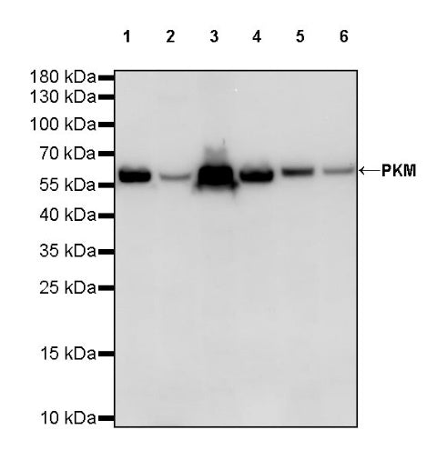PKM Recombinant Rabbit mAb (S-812-20)