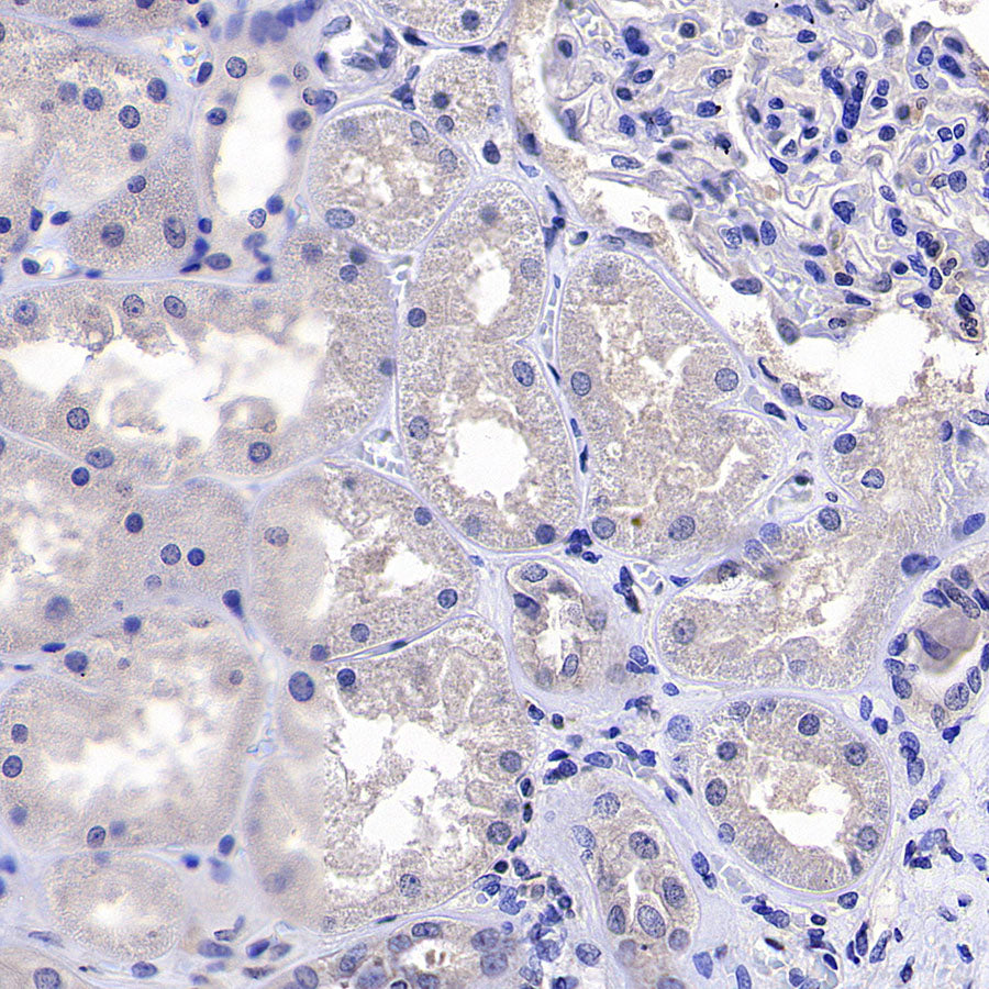 TRIM21 Mouse mAb (S-M0045)
