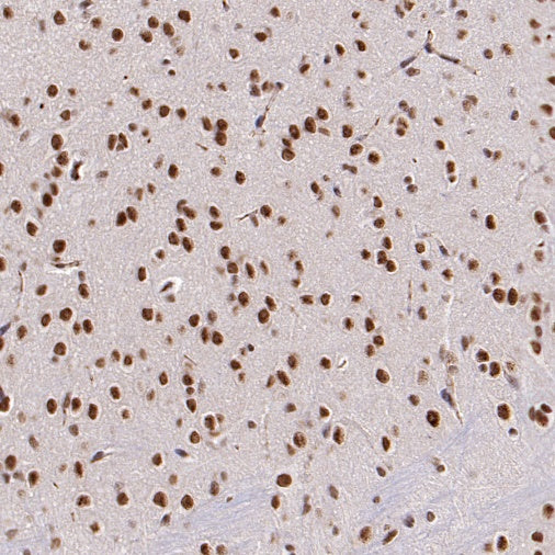 SF2 Recombinant Rabbit mAb (S-1845-27)