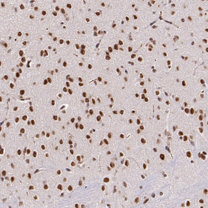 SF2 Recombinant Rabbit mAb (S-1845-27)