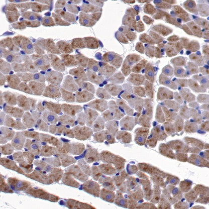 NDUFA1 Recombinant Rabbit mAb (S-1277-177)