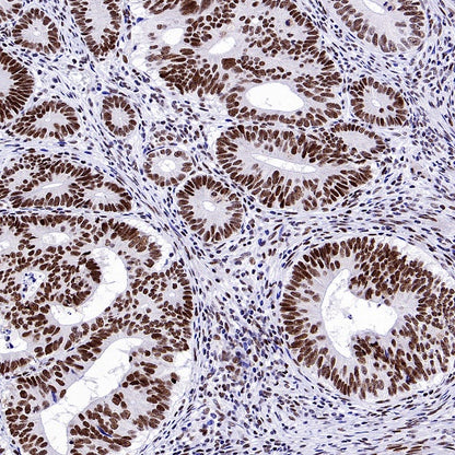 Symmetric Dimethyl Arginine (SDMA) Rabbit mAb (S-2129-14)