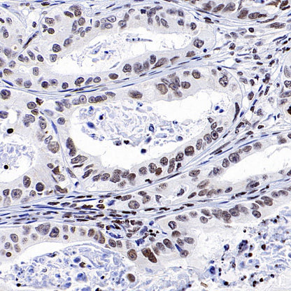 SIRT1 Recombinant Rabbit mAb (S-1886-15)