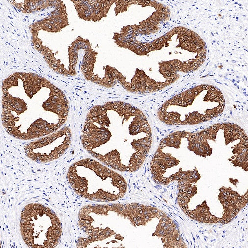 KLK2 Recombinant Rabbit mAb (SDT-4461-19)