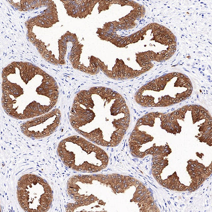 KLK2 Recombinant Rabbit mAb (SDT-4461-19)