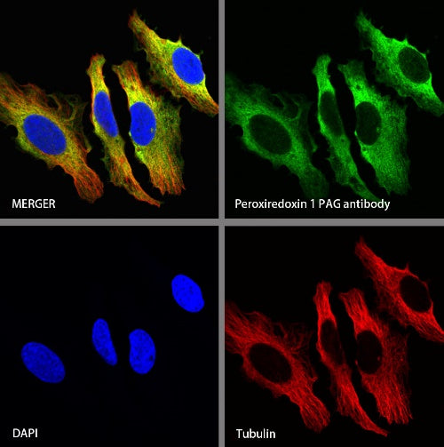 Peroxiredoxin 1/PAG Recombinant Rabbit mAb (S-1673-22)