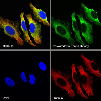 Peroxiredoxin 1/PAG Recombinant Rabbit mAb (S-1673-22)