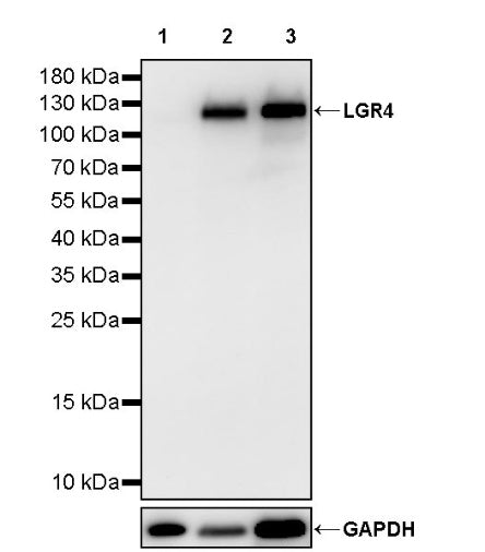 LGR4 Recombinant Rabbit mAb (S-2787-39)