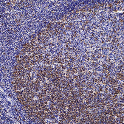 CDK2 Recombinant Rabbit mAb (SDT-064-40)