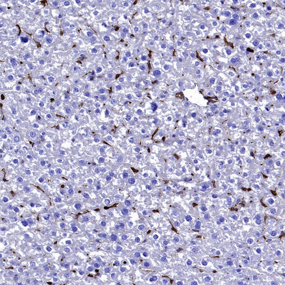 PKC delta Recombinant Rabbit mAb (S-2611-39)