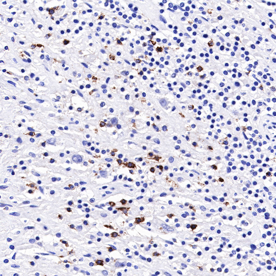 LAG3 Recombinant Rabbit mAb (SDT-R159)
