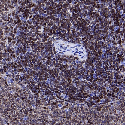 p27 Kip1 Recombinant Rabbit mAb (SDT-361-310)