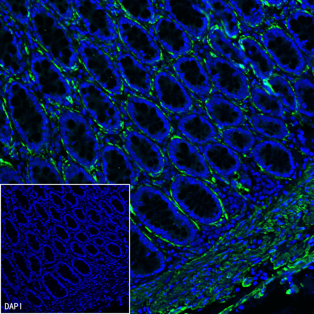 S-RMab® alpha smooth muscle Actin (SMA) Recombinant Rabbit mAb (SDT-301-142)