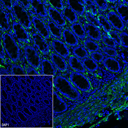 S-RMab® alpha smooth muscle Actin (SMA) Recombinant Rabbit mAb (SDT-301-142)