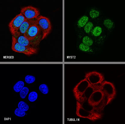 MYST2 Recombinant Rabbit mAb (S-3730-123)
