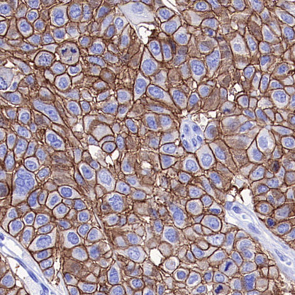 ABCC1/MRP1 Recombinant Rabbit mAb (SDT-4056-11)