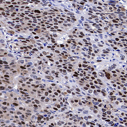 PCNA Recombinant Rabbit mAb (S-5313)
