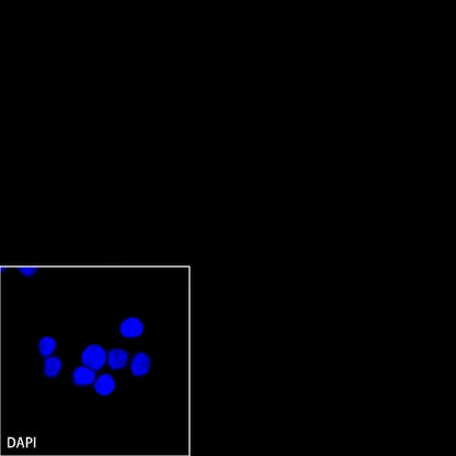 CD19 Recombinant Rabbit mAb (SDT-164-41)