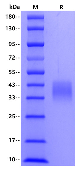 Human CD200 Protein, His Tag