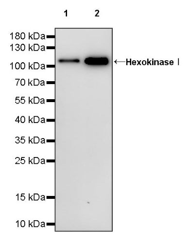 HexokinaseⅠRecombinant Rabbit mAb (S-868-113)