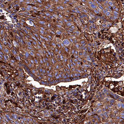 β-Actin Recombinant Rabbit mAb (S-5701)