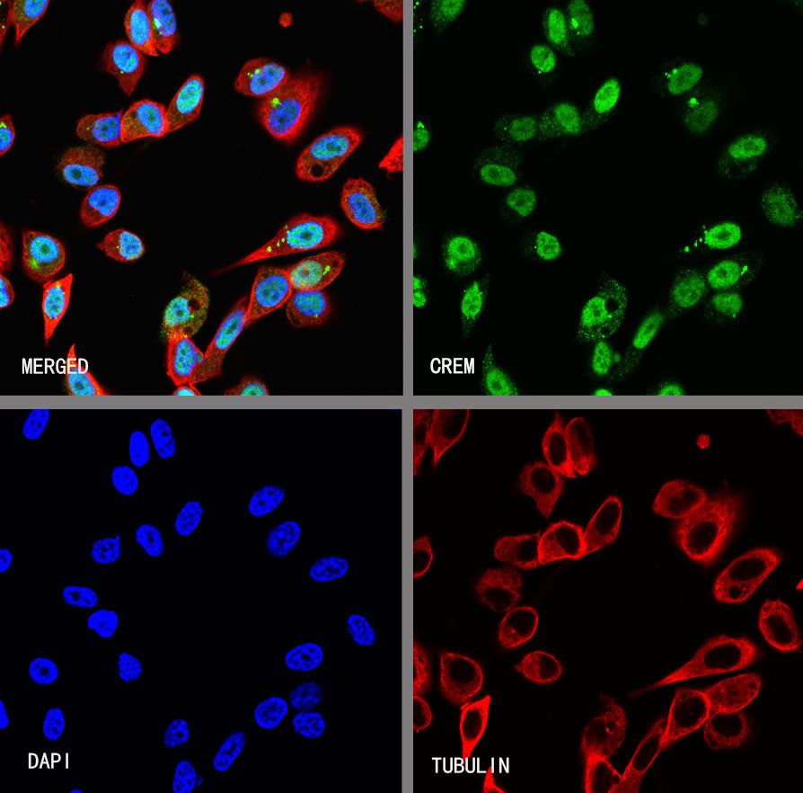 CREM Recombinant Rabbit mAb (S-3375-19)