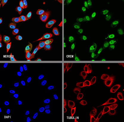 CREM Recombinant Rabbit mAb (S-3375-19)