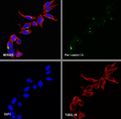Pericentrin Recombinant Rabbit mAb (S-3493)