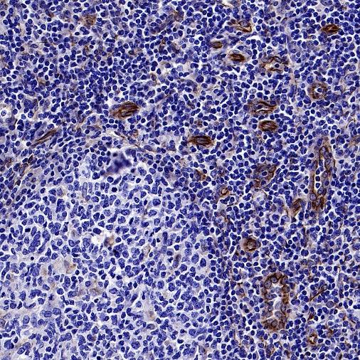 SDF1/CXCL12 Recombinant Rabbit mAb (SDT-3675)