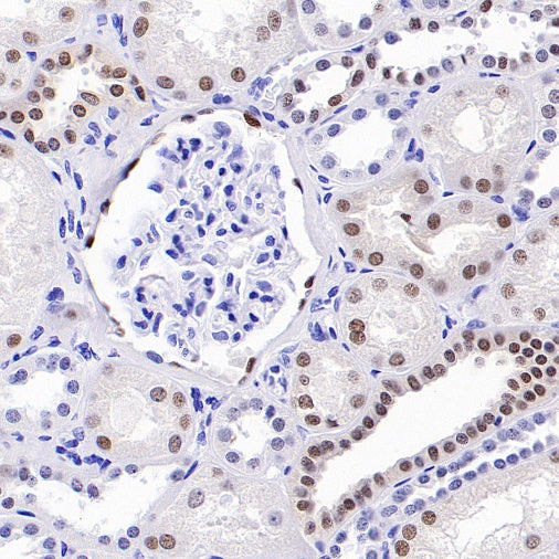 PAX8 Recombinant Rabbit mAb (SDT-R509)