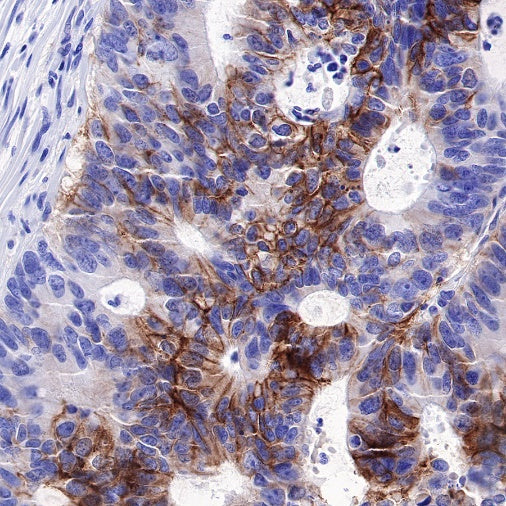 Carbonic Anhydrase 9 Recombinant Rabbit mAb (SDT-733-28)
