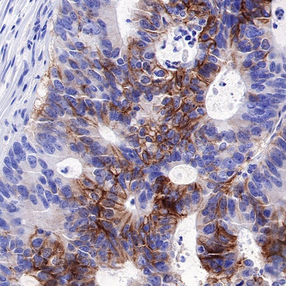 Carbonic Anhydrase 9 Recombinant Rabbit mAb (SDT-733-28)