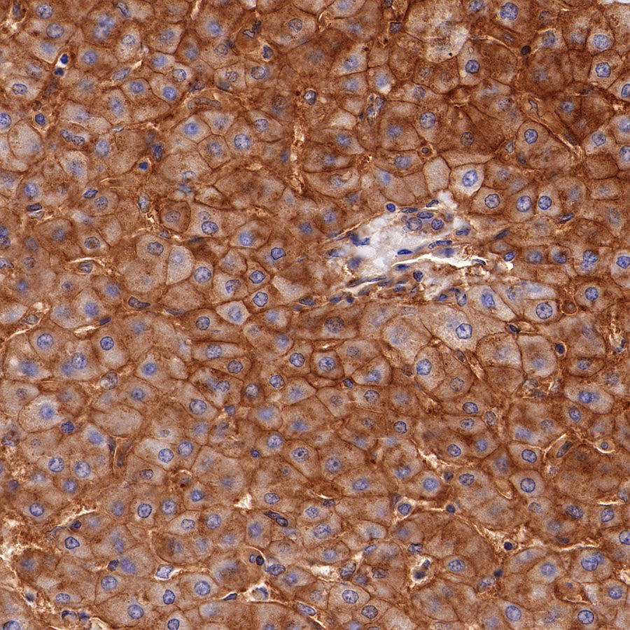 CD155/PVR Recombinant Rabbit mAb (SDT-289-68)