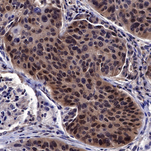 MGMT Recombinant Rabbit mAb (SDT-522-71)