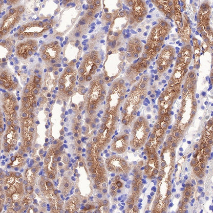 LDH-C/A Recombinant Rabbit mAb (S-R328)