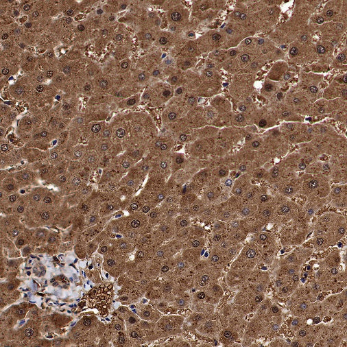 Catalase Rabbit Polyclonal Antibody