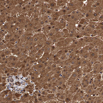 Catalase Rabbit Polyclonal Antibody