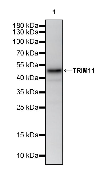 TRIM11 Recombinant Rabbit mAb (S-2913-79)