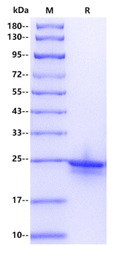 Human PRDM1/Blimp1 Protein, His tag