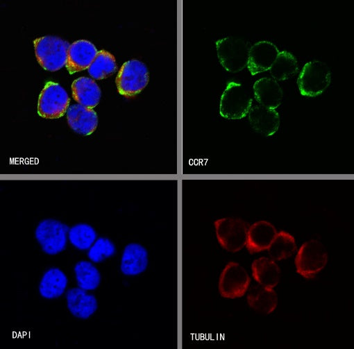 CCR7 Recombinant Rabbit mAb (S-R333)