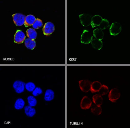 CCR7 Recombinant Rabbit mAb (S-R333)