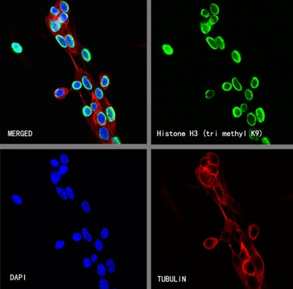 Histone H3 (tri methyl K9) Recombinant Rabbit mAb (S-3826)