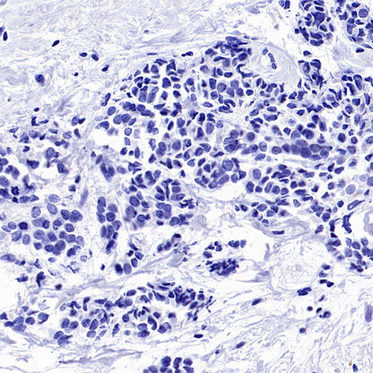 TMEM16A Recombinant Rabbit mAb (SDT-2179-12)