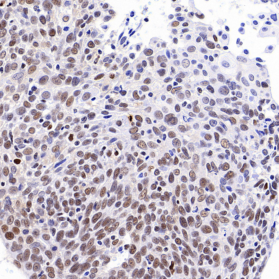 TBX18 Recombinant Rabbit mAb (S-4619-17)