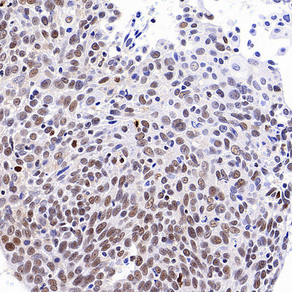 TBX18 Recombinant Rabbit mAb (S-4619-17)
