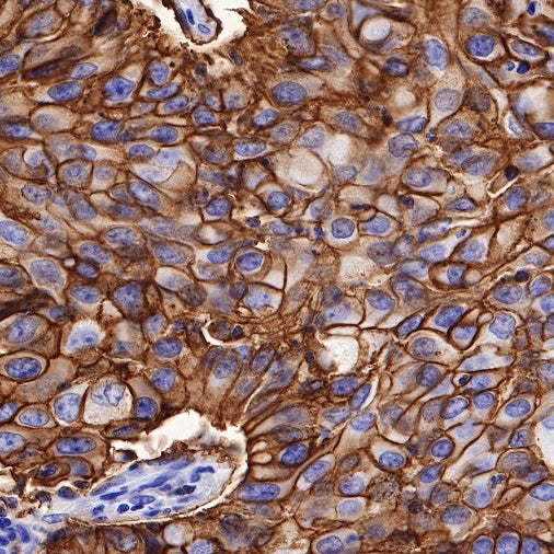 SLC7A5/LAT1 Recombinant Rabbit mAb (S-367-12)