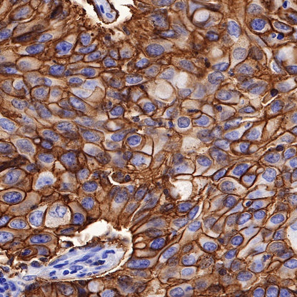 SLC7A5/LAT1 Recombinant Rabbit mAb (S-367-12)