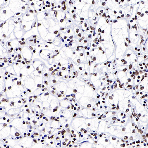 ARID1A Recombinant Rabbit mAb (S-440-27)